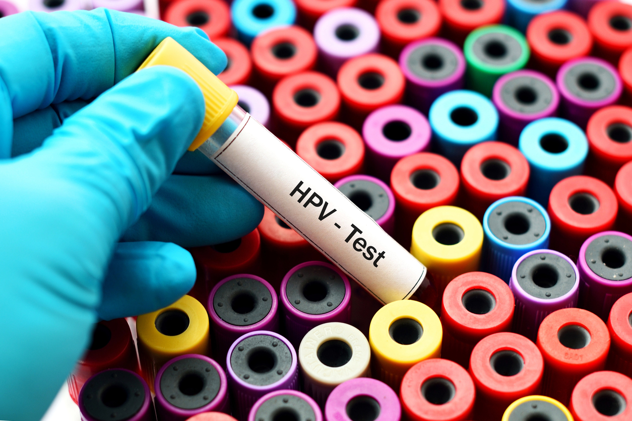 Általánosan a HPV fertőzésről 